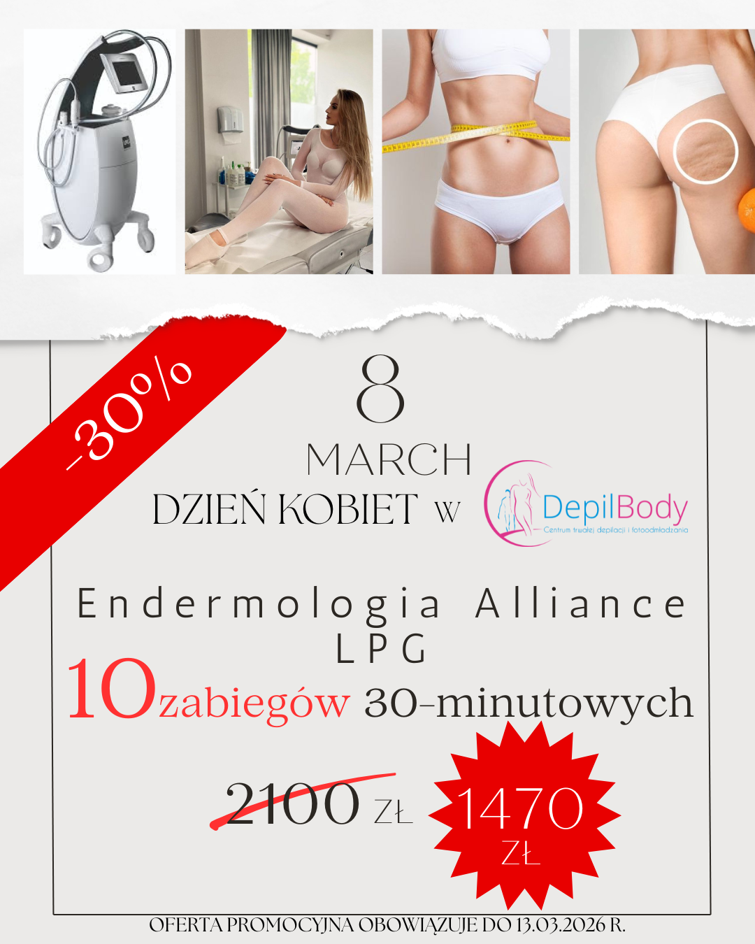 Endermologia Alliance LPG (1)